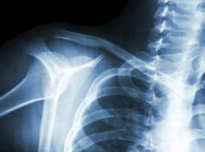 Athletic Injuries